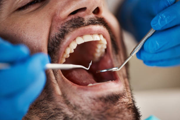 Best Emergency Dental Care for Broken or Chipped Teeth in Franklin Park, NJ